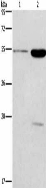 GABRG2 Antibody (PACO19688)