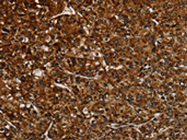 NDUFAB1 Antibody (PACO20074)