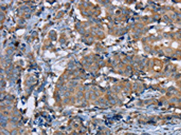 PON1 Antibody (PACO20264)