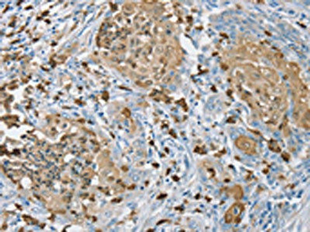 S100A9 Antibody (PACO20375)