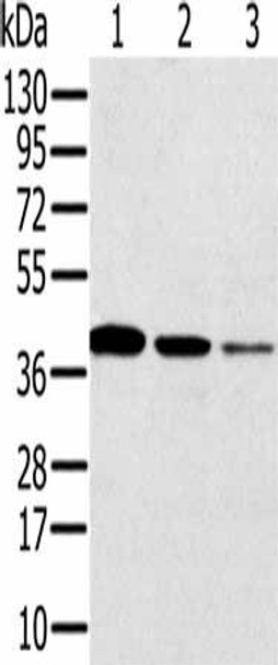 SYCP3 Antibody (PACO20409)