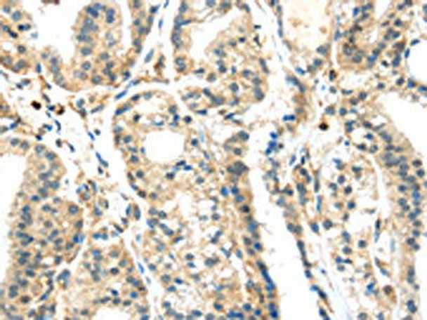 SIGLEC8 Antibody (PACO20461)