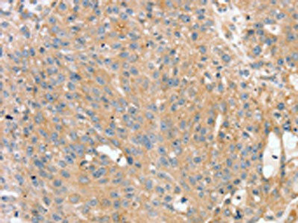 PTX3 Antibody (PACO20720)