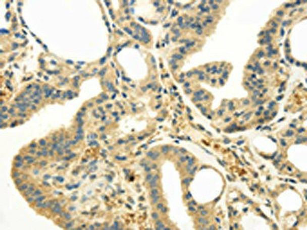 UGT1A6 Antibody (PACO20822)