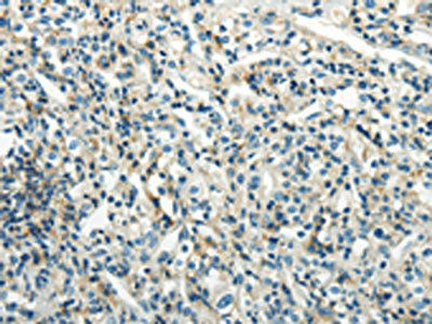 PDPN Antibody (PACO20912)