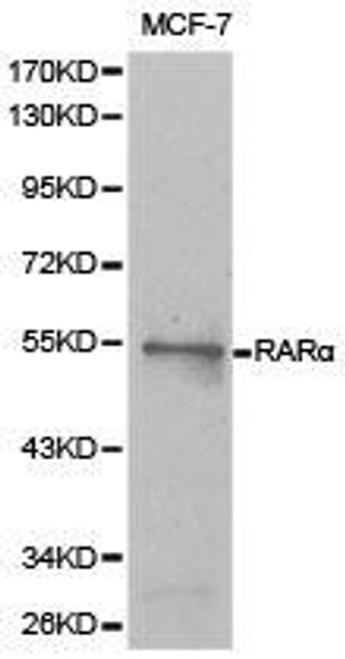 RARA Antibody (PACO21049)