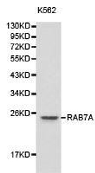 RAB7A Antibody (PACO21085)