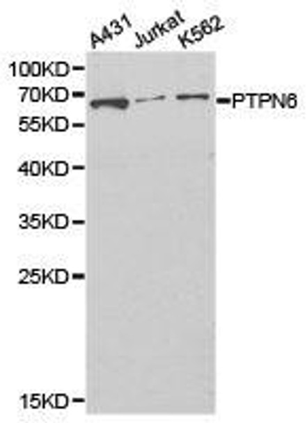 PTPN6 Antibody (PACO21136)