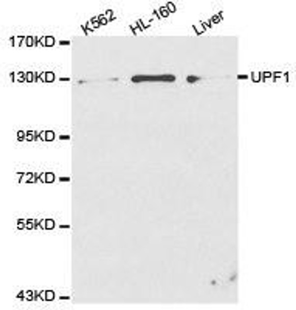 UPF1 Antibody (PACO21146)
