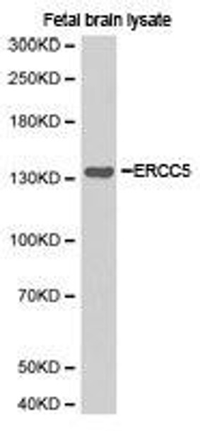 ERCC5 Antibody (PACO21162)