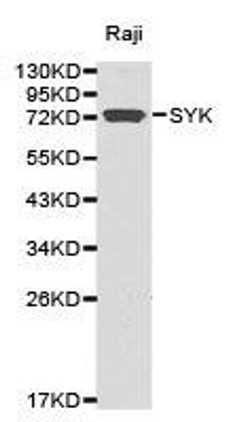SYK Antibody (PACO21256)