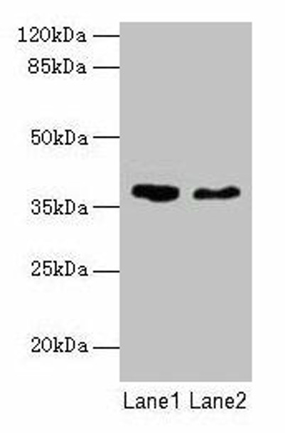 AGA Antibody (PACO24807)