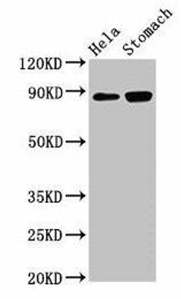 ASAH2 Antibody (PACO25076)