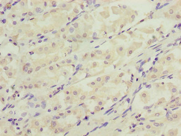 DDIT3 Antibody (PACO26185)