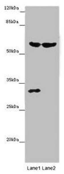 TERF2 Antibody (PACO46530)