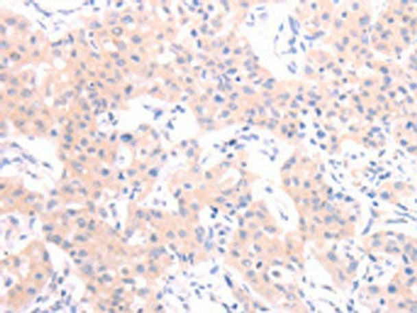 HCRT Antibody (PACO18794)