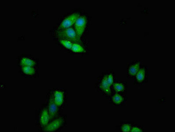 CTLA4 Antibody (PACO54270)