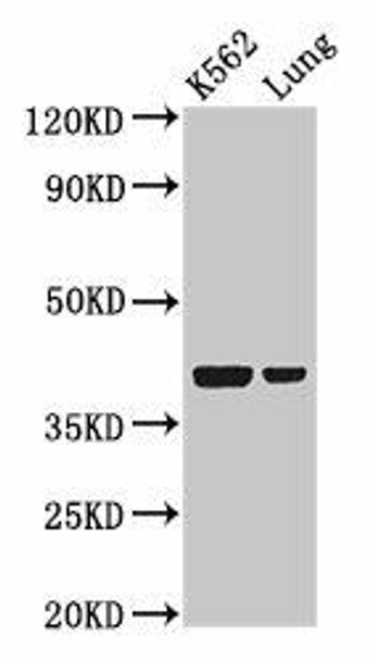 PTX3 Antibody (PACO54966)