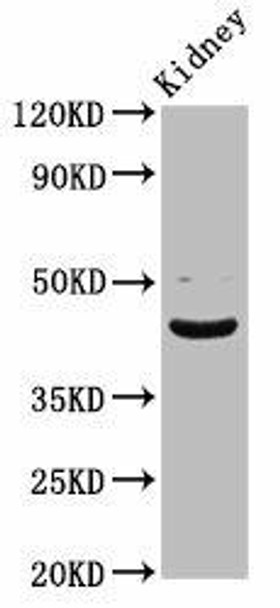 LHX2 Antibody (PACO56872)