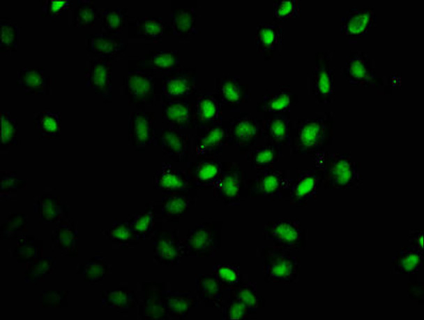 RAG2 Antibody (PACO61618)