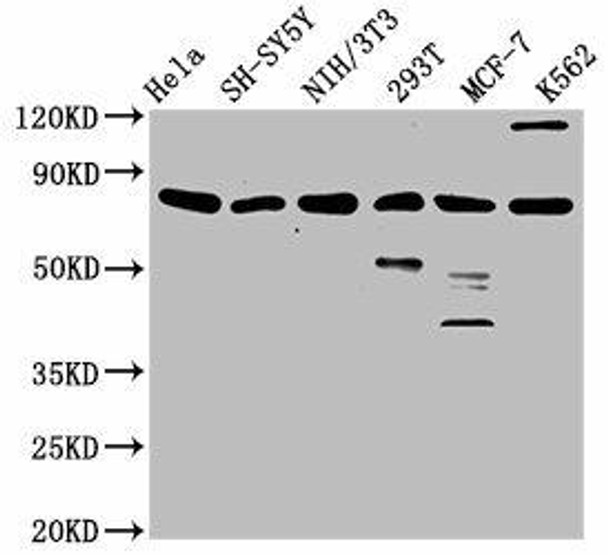 KMT2E Antibody (PACO61878)