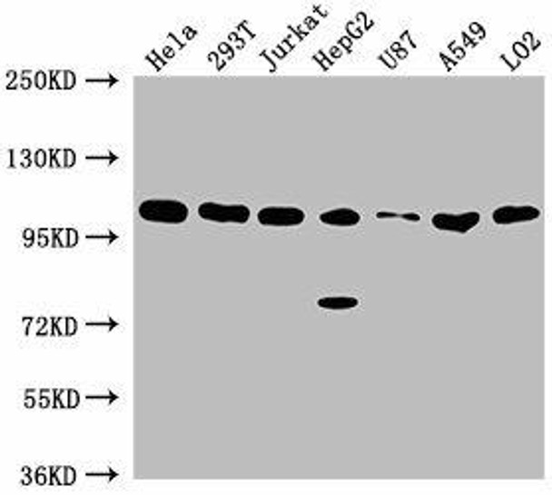 ADAR Antibody (PACO62123)