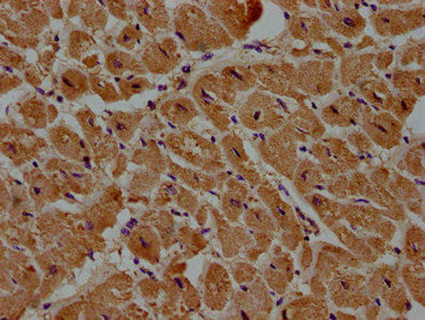 DIXDC1 Antibody (PACO62187)