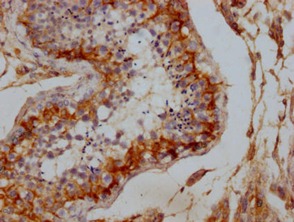 DLG4 Antibody (PACO64111)