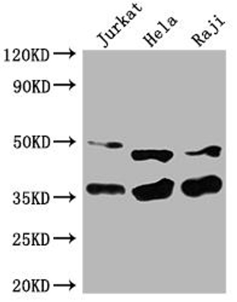 NFKBIA Antibody (PACO64339)