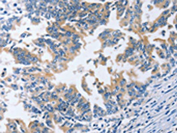 AMACR Antibody (PACO14020)