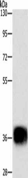 CEBPE Antibody (PACO14239)