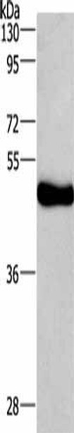 UGCG Antibody (PACO14458)