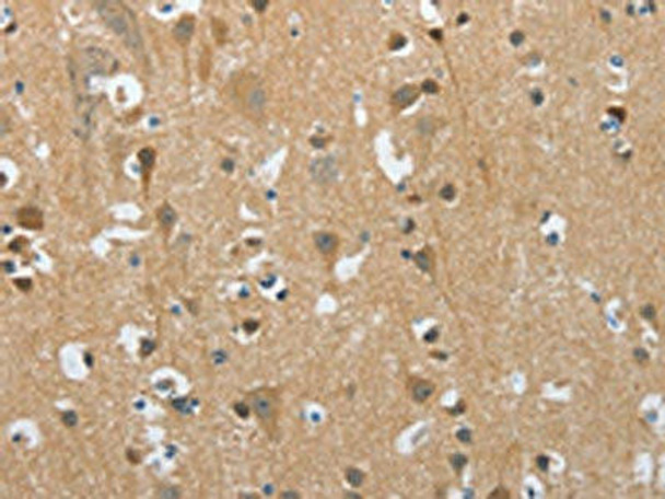 PITX3 Antibody (PACO19179)