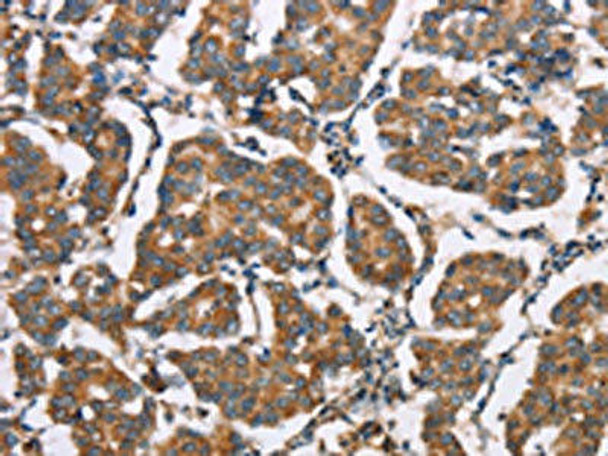 ELP3 Antibody (PACO19234)