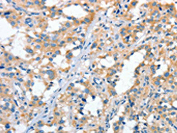 STAT2 Antibody (PACO19286)