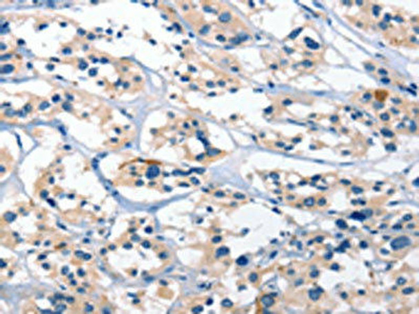 BNIP3L Antibody (PACO19310)