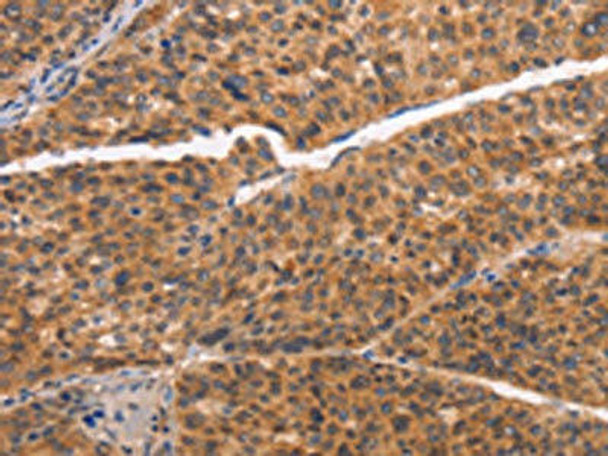 NCAPG2 Antibody (PACO19385)