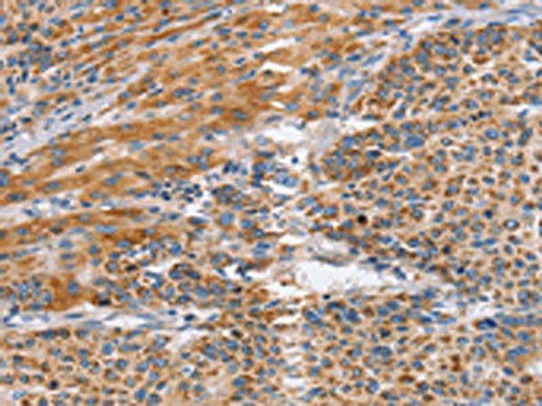 SIGLEC6 Antibody (PACO19419)