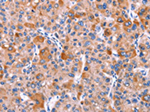 GCG Antibody (PACO19633)