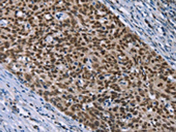 HMGA1 Antibody (PACO18065)