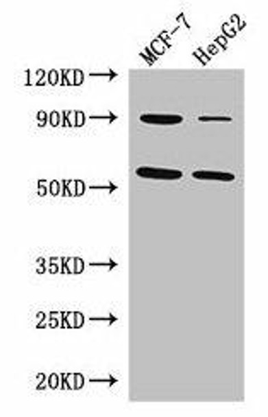 FOXC1 Antibody (PACO48594)