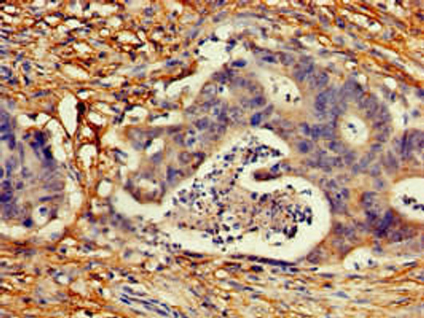 CDKN2C Antibody (PACO49462)