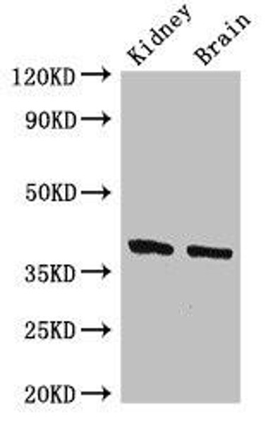 FOXE1 Antibody (PACO49594)
