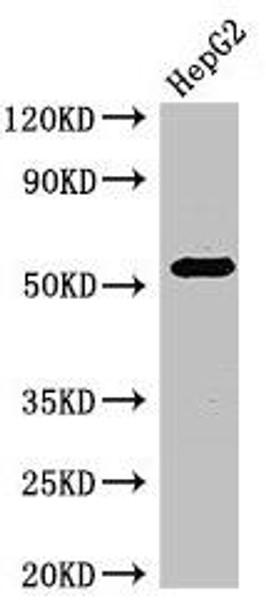 GABRB3 Antibody (PACO49614)