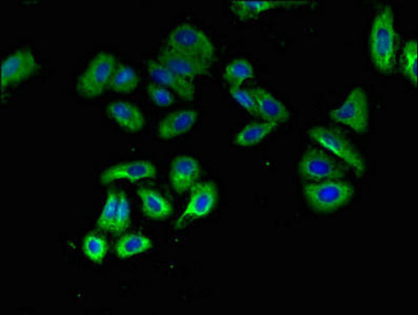 OXTR Antibody (PACO49842)