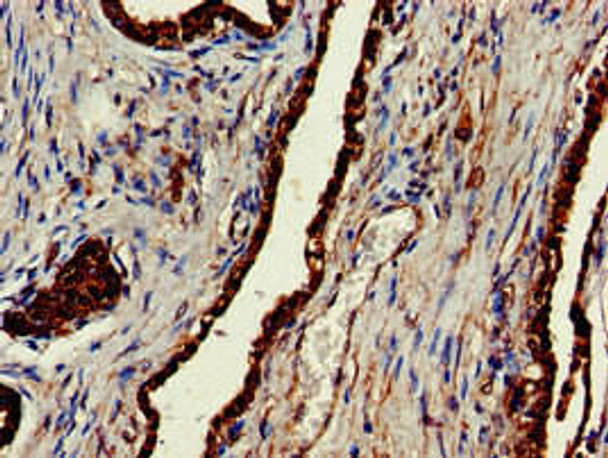 CLINT1 Antibody (PACO51434)