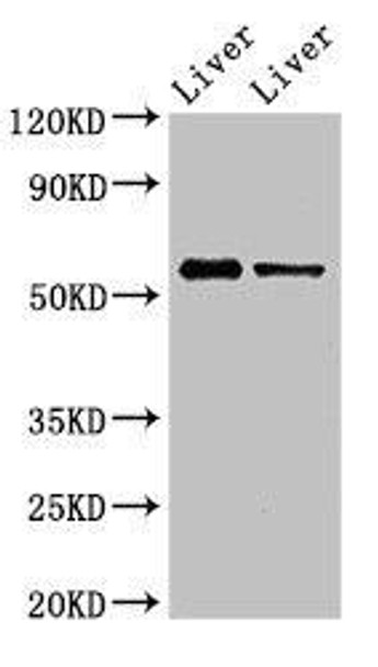 ETV1 Antibody (PACO53014)