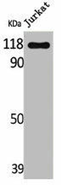 ARHGEF2 Antibody (PACO06613)