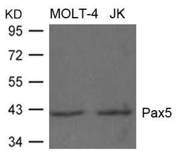 PAX5 Antibody (PACO21524)