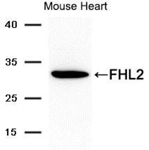 FHL2 Antibody (PACO21575)
